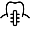 Імплантація зубів